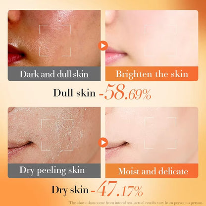 BIOAQUA Vitamin E + B5 Skincare Set – 6-Piece Moisturizing & Anti-Aging Routine